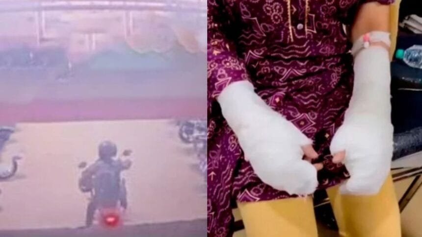दिल्ली एसिड अटैक फर्जी मामला पिता गिरफ्तार
