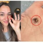 साईनस मानकर किया इग्नोर,सीटी स्कैन में खुला राज तो उड़ गए होश!