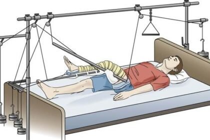 जानिए ट्रैक्शन के पीछे का साइंटिफिक सच